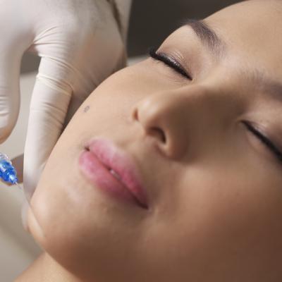 Perlukah Percantik Diri dengan Teknologi Kecantikan Filler?